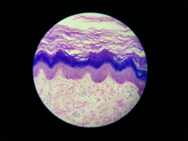 Stratified Squamous Epithelium Slides - Stratified Squamous Epithelium 16 400X